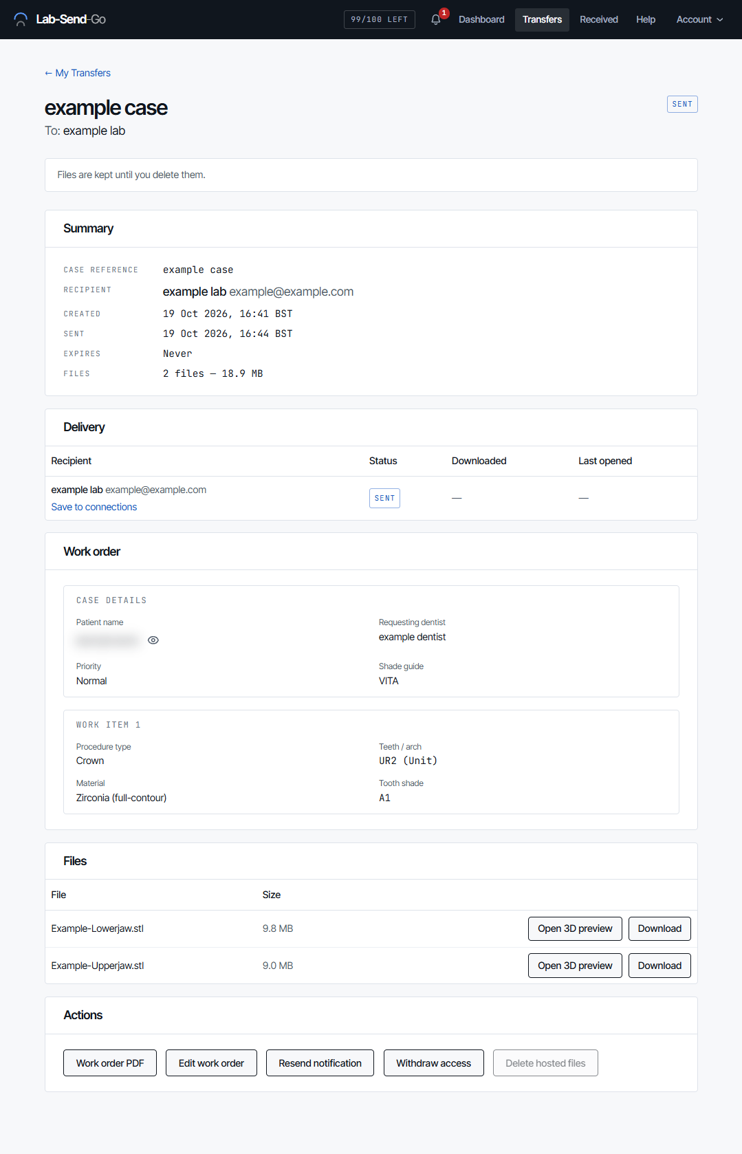 Transfer detail page showing the summary, the Delivery table with each recipient's status, the work order and the actions.